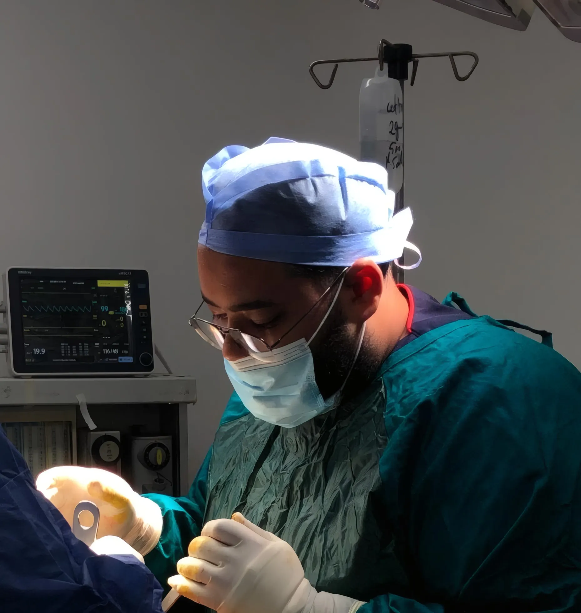 د. أبانوب أيمن بغطاء الرأس الجراحي والنظارة والقناع، منهمكًا في عملية تحت إضاءة غرفة العمليات، وبجانبه شاشة متابعة المريض